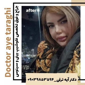 جراحی-بینی26