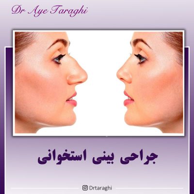 جراحی بینی استخوانی