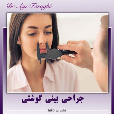جراحی بینی گوشتی
