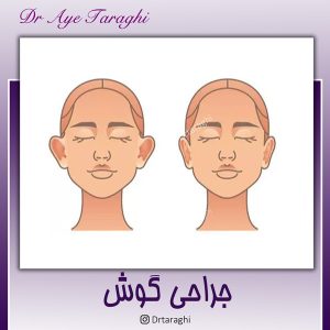 جراحی گوش