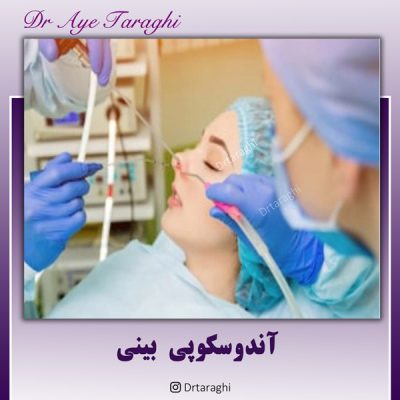 آندوسکوپی بینی