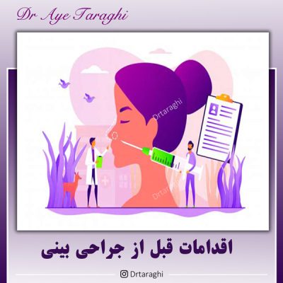 اقدامات قبل از جراحی بینی