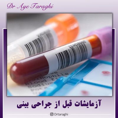 اقدامات قبل از جراحی بینی