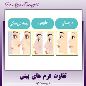جراحی بینی طبیعی