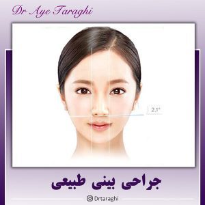 جراحی بینی طبیعی