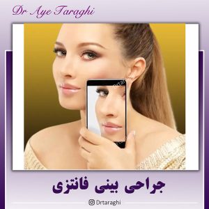 جراحی بینی فانتزی