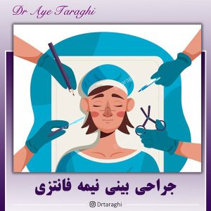 جراحی بینی نیمه فانتزی