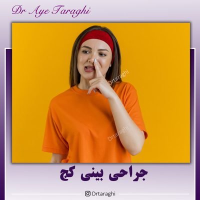 جراحی بینی کج