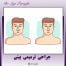 جراحی ترمیمی بینی