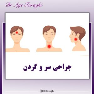 جراحی سر و گردن