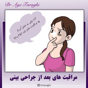 مراقبت های بعد از جراحی بینی