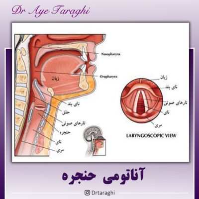 مشکلات صوتی