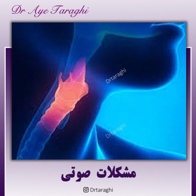 مشکلات صوتی