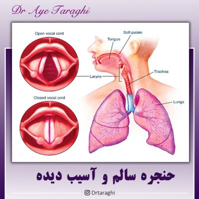 مشکلات صوتی