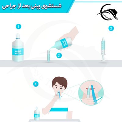 شستشوی بینی بعد از جراحی