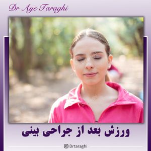 ورزش کردن بعد از جراحی بینی