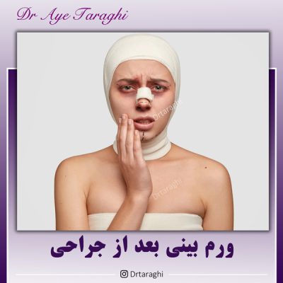 ورم بینی بعد از جراحی
