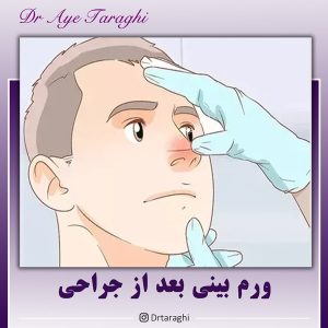 ورم بینی بعد از جراحی