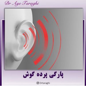 پارگی پرده گوش