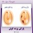 پارگی پرده گوش - دکتر آیه ترقی