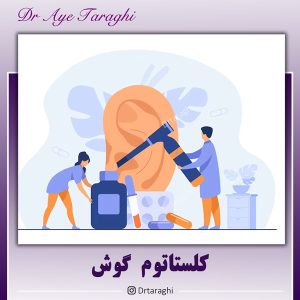 کلستاتوم گوش - دکتر آیه ترقی