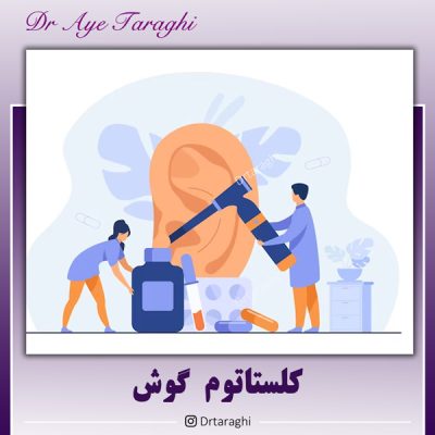 کلستاتوم گوش - دکتر آیه ترقی