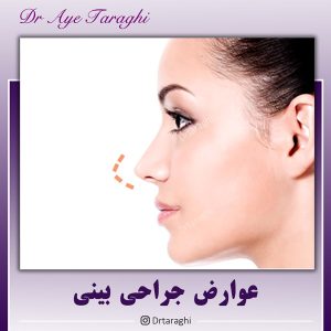 عوارض جراحی بینی - دکتر ترقی