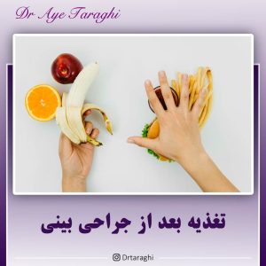 تغذیه بعد از جراحی بینی-دکتر آیه ترقی