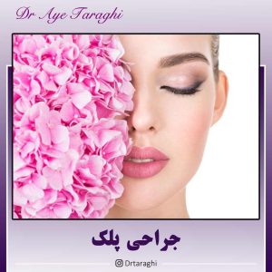 جراحی پلک-دکتر آیه ترقی